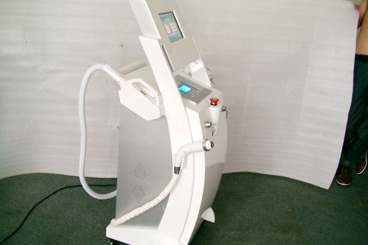 Nd YAG laser hair removal