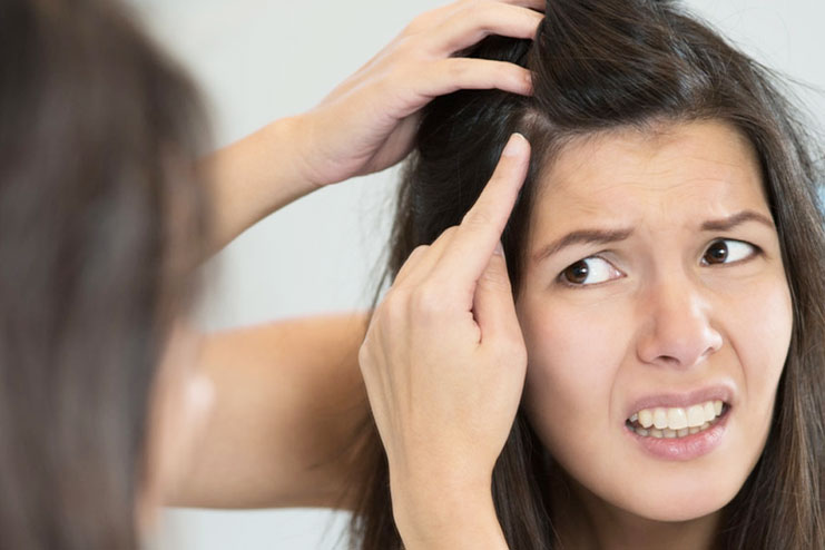 Anti-Dandruff