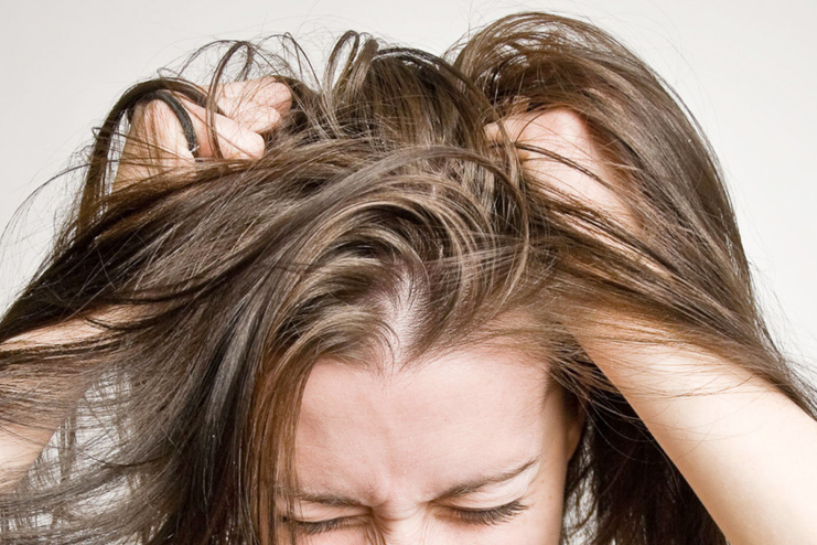 Fights Stubborn Dandruff