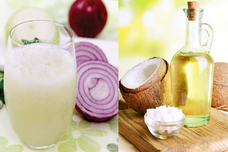 Onion Juice And Coconut Oil Pack