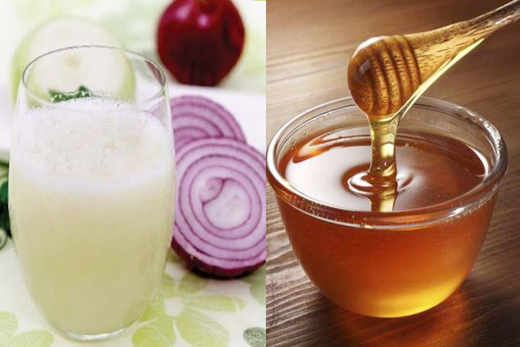 Onion Juice And Honey Hair Mask