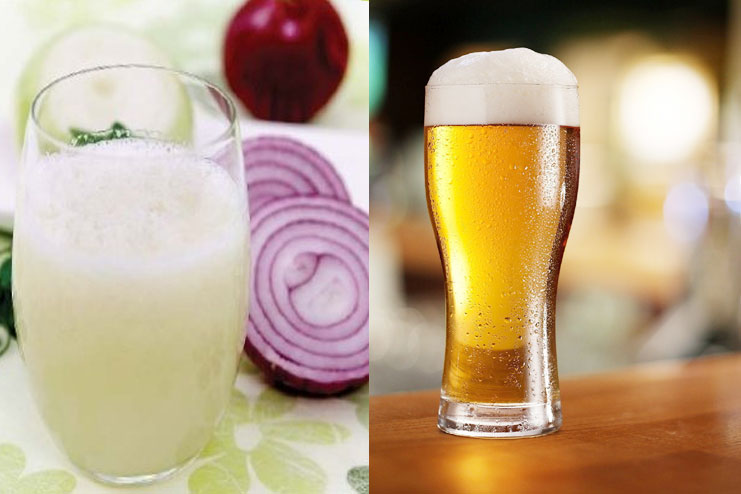 Onion Juice And Beer For Hair Growth