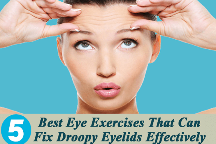 exercises to get rid from drooping eyelids