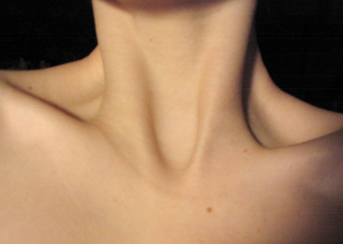 Neck