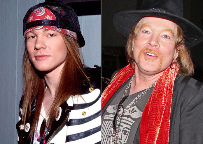 Axl Rose