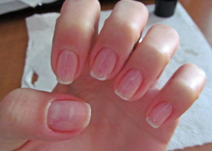 Moisturize Nails