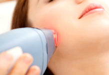 laser treatments for facial hair