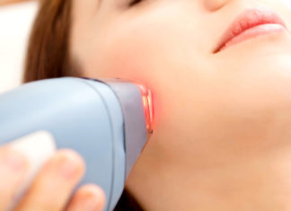 laser treatments for facial hair