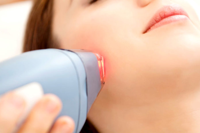 laser treatments for facial hair