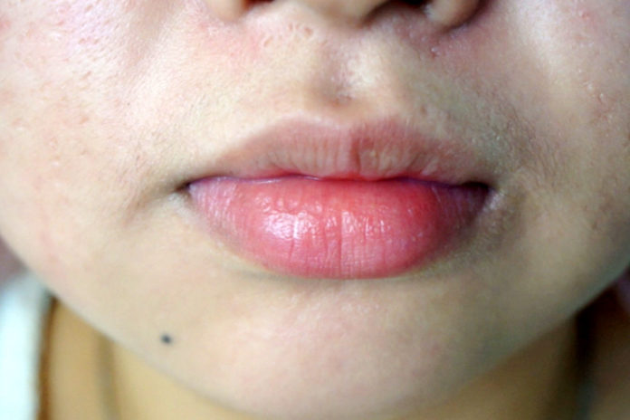 Pale lips