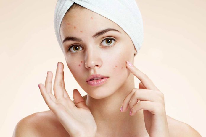 Clear Up Acne