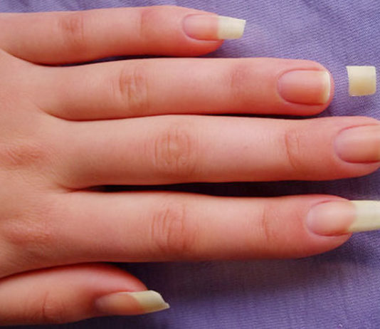 Broken Nails