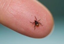 Home Remedies To Treat Lyme Disease