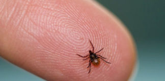 Home Remedies To Treat Lyme Disease