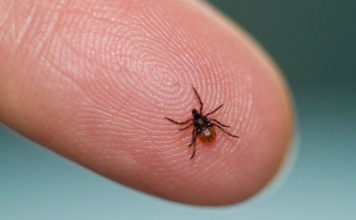 Home Remedies To Treat Lyme Disease