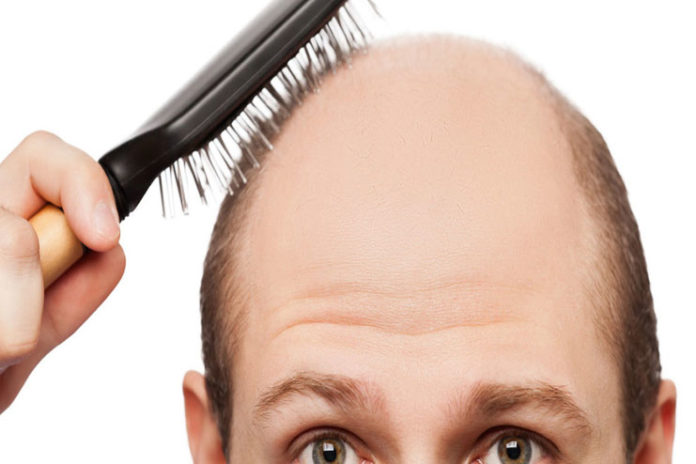 Home remedy for alopecia