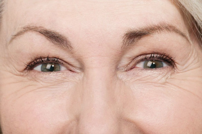 Treatment of Wrinkles