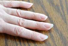 dry cuticles