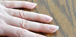 dry cuticles