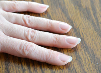 dry cuticles