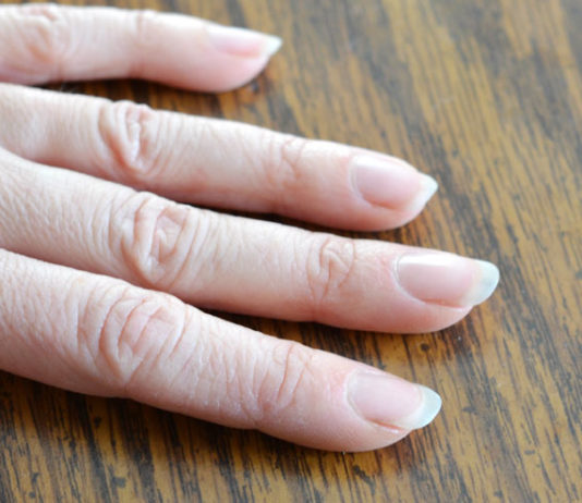 dry cuticles