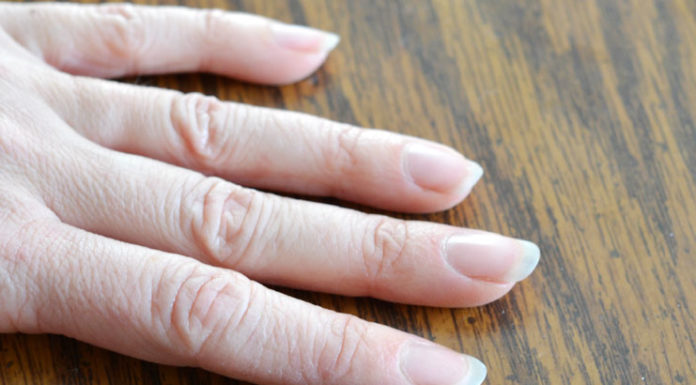 dry cuticles