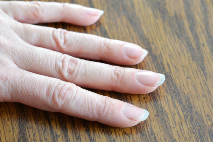 dry cuticles