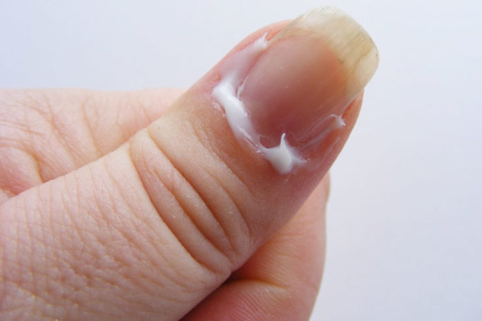 Moisturize Your Cuticles