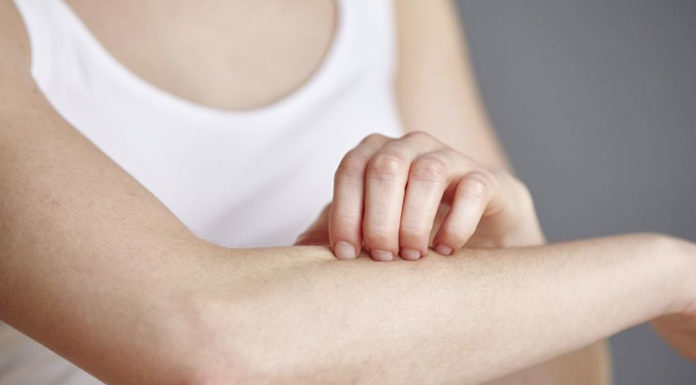 Home Remedies For Skin Rashes