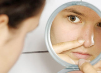 Baking Soda For Blackheads