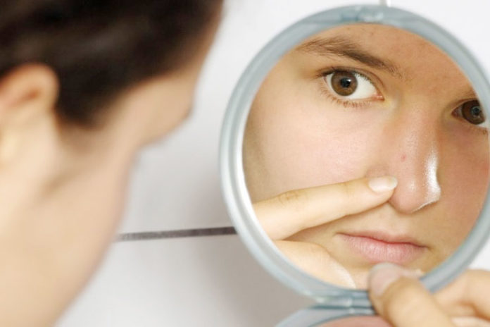 Baking Soda For Blackheads