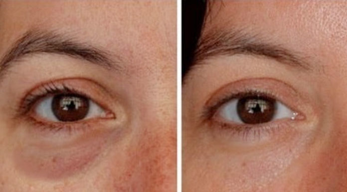 Rejuvenate tired eyes