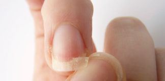 prevent your nails from breaking