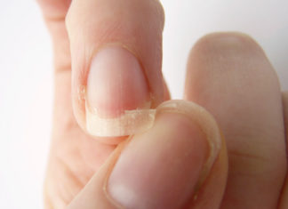 prevent your nails from breaking