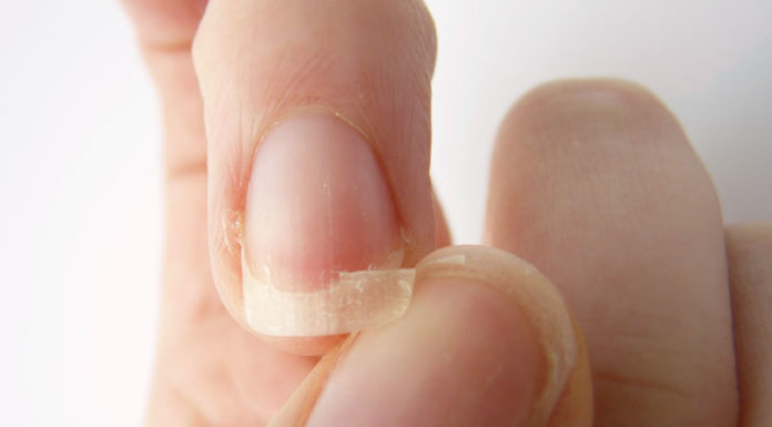 prevent your nails from breaking