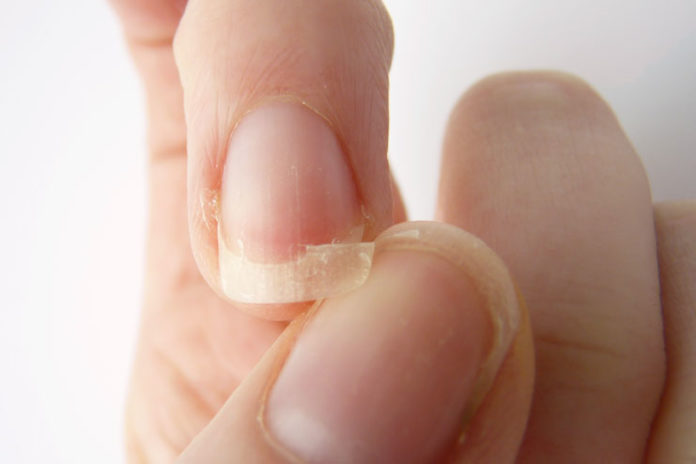 prevent your nails from breaking