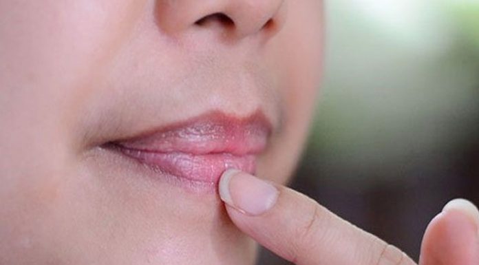 Lip balm for dark lips