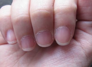 Dry-cuticles