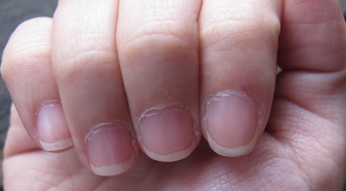 Dry-cuticles