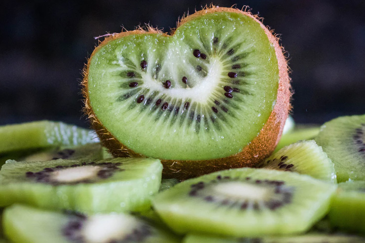 Kiwis