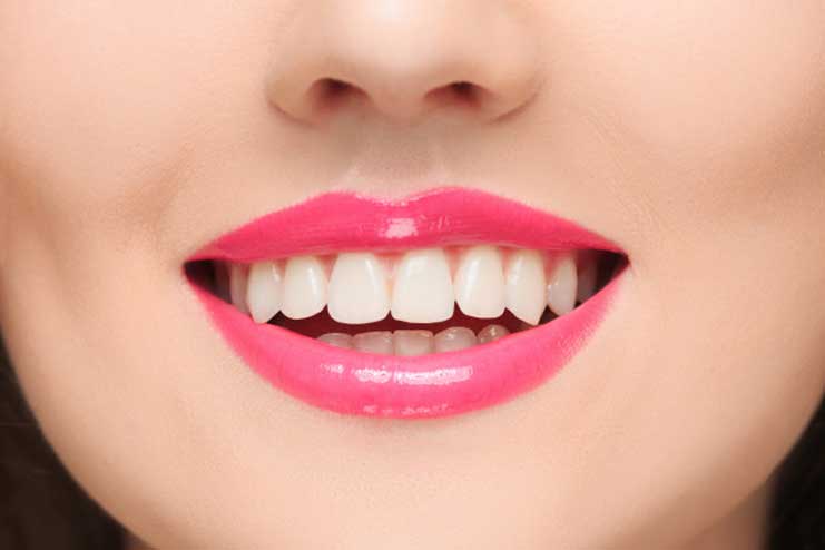 Woman-with-curved-philtrum-on-upper-lip