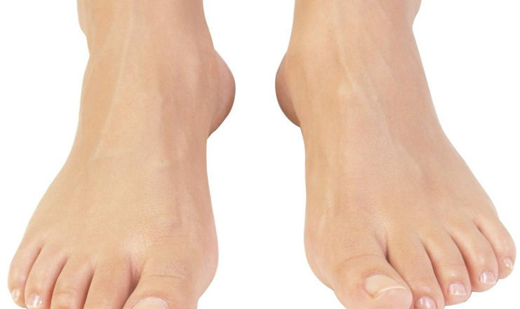 Home-remedies-to-get-rid-of-sore-foot