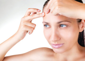 Home-Remedies-to-Get-Rid-Of-Whiteheads