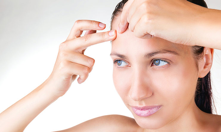 Home-Remedies-to-Get-Rid-Of-Whiteheads